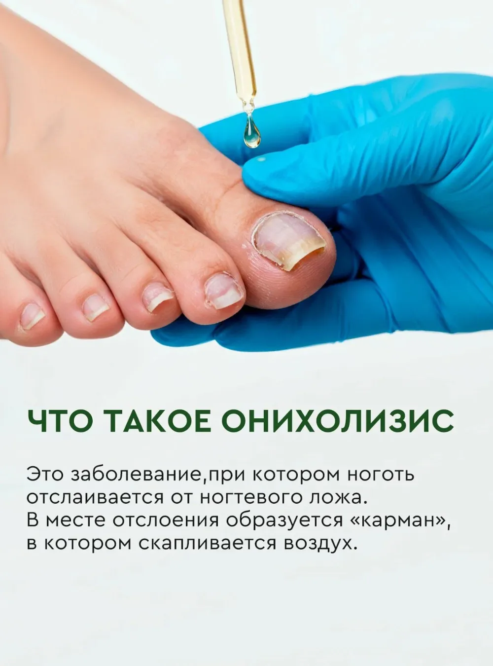 Сыворотка реген стоп онихолизис Монарда, Шалфей, Чайное дерево, 30 мл.