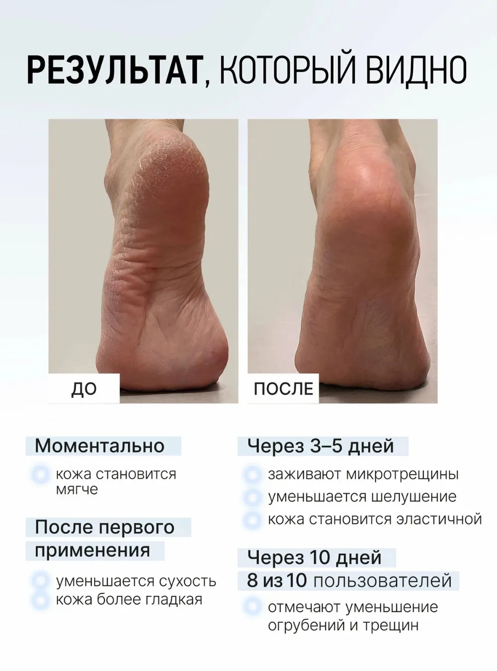 Крем для ног смягчающий Amino Healing заживление и защита от трещин кожи с Мочевиной и Аминокислотами, 100 мл.