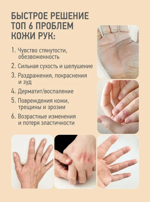 Крем для рук и проблемных зон восстанавливающий микробиом кожи S.O.S.Repair+ с пробиотиками и церамидами, 100 мл.